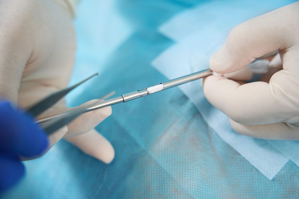 Gloved hands holding a metal surgical instrument over a blue sterile drape.