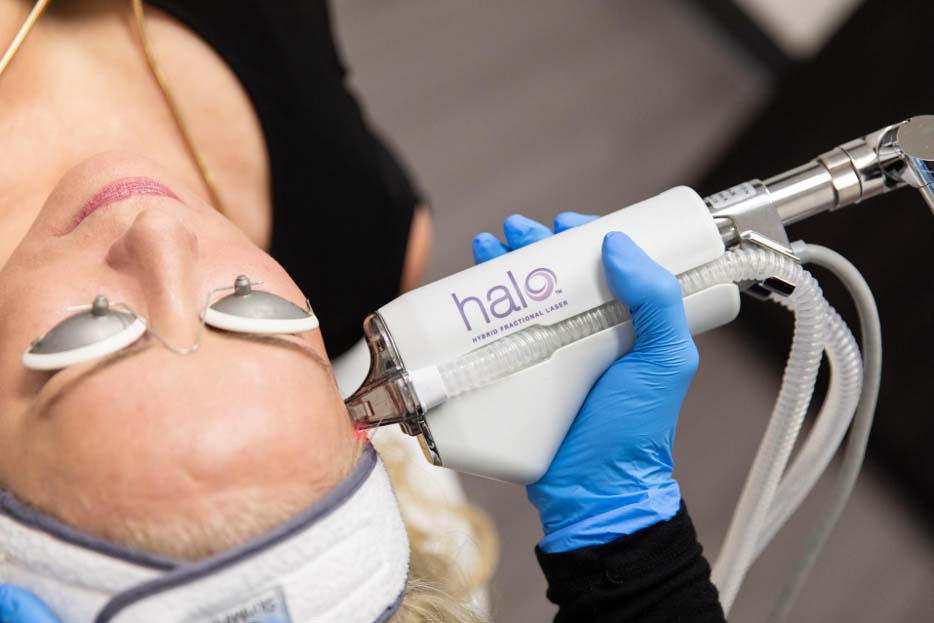 A person wearing protective eye covers lies on a table while a gloved practitioner holds a Halo-branded device to the forehead.