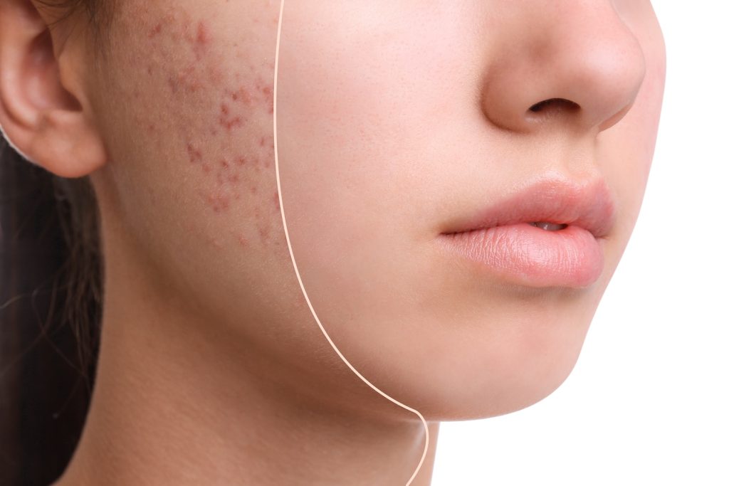 Close-up of a person’s face showing a vertical split, with visible skin texture differences on the cheek area.