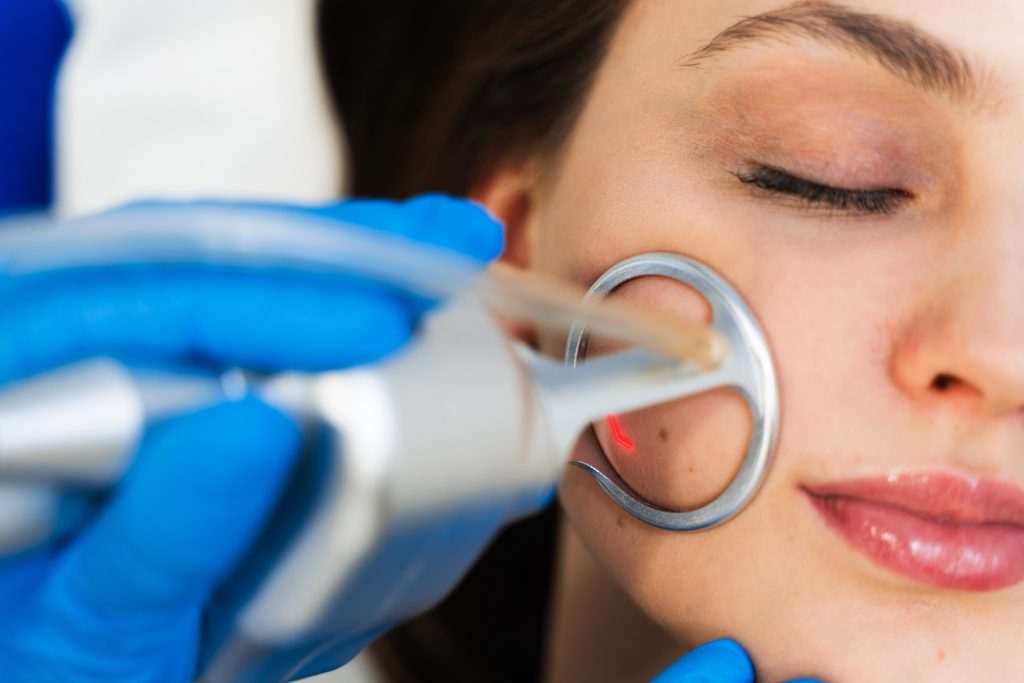 Gloved hand uses a circular laser device on a person’s cheek while the person’s eyes are closed