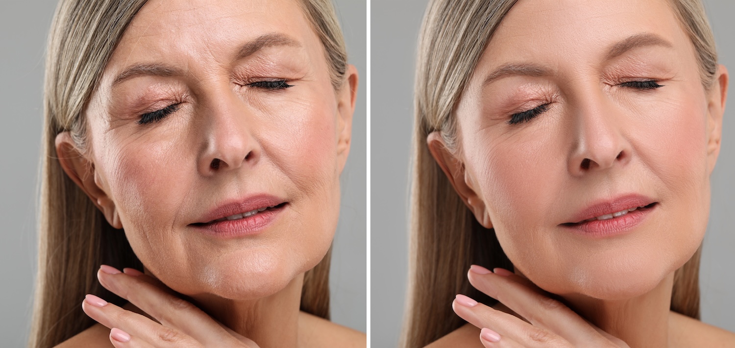 Side-by-side close-up of a woman’s face with eyes closed, showing two similar facial views separated by a vertical line