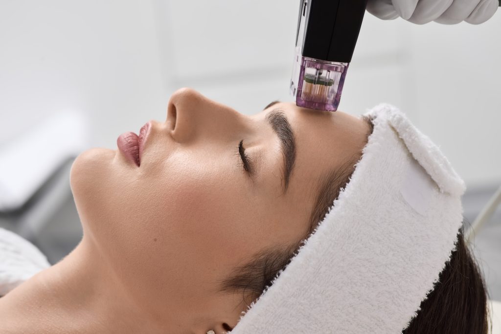 Microneedling device touches a person’s forehead while the person lies down wearing a headband